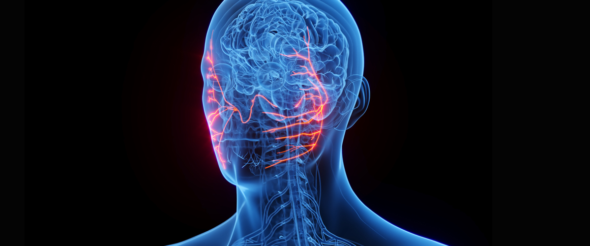 What is Ramsay Hunt Syndrome?
