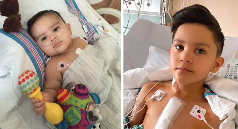Yasin, after his first and third open-heart surgeries.