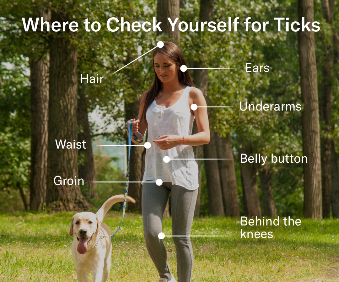 Prevent tick bites by checking in these areas for ticks
