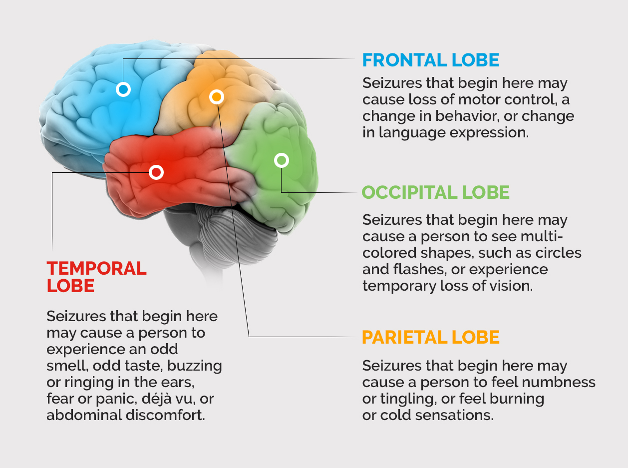 A person will experience different symptoms depending on where a seizure starts in their brain.