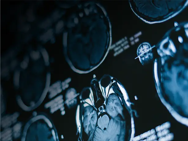 Neurology and Neurosurgery