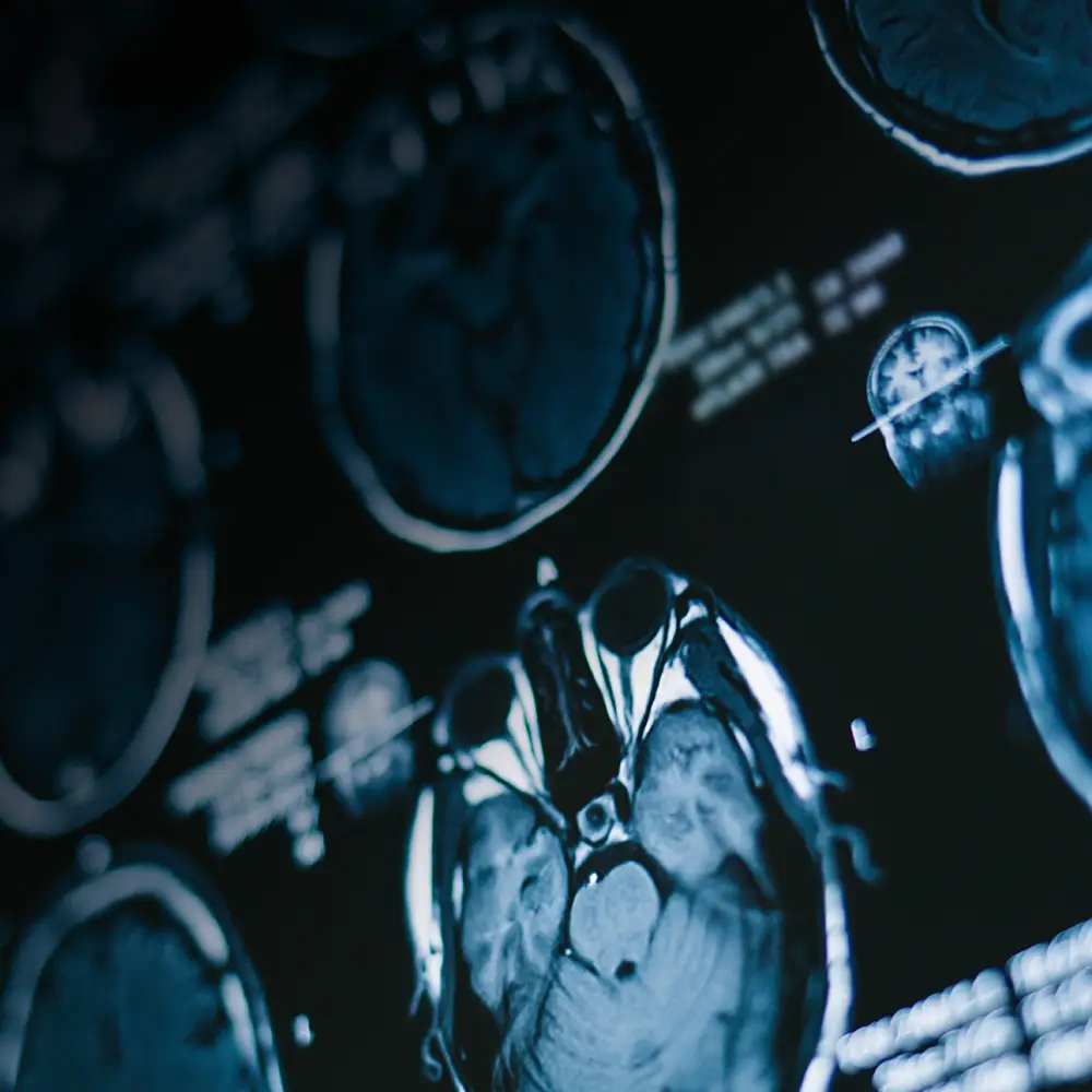 Neurology and Neurosurgery