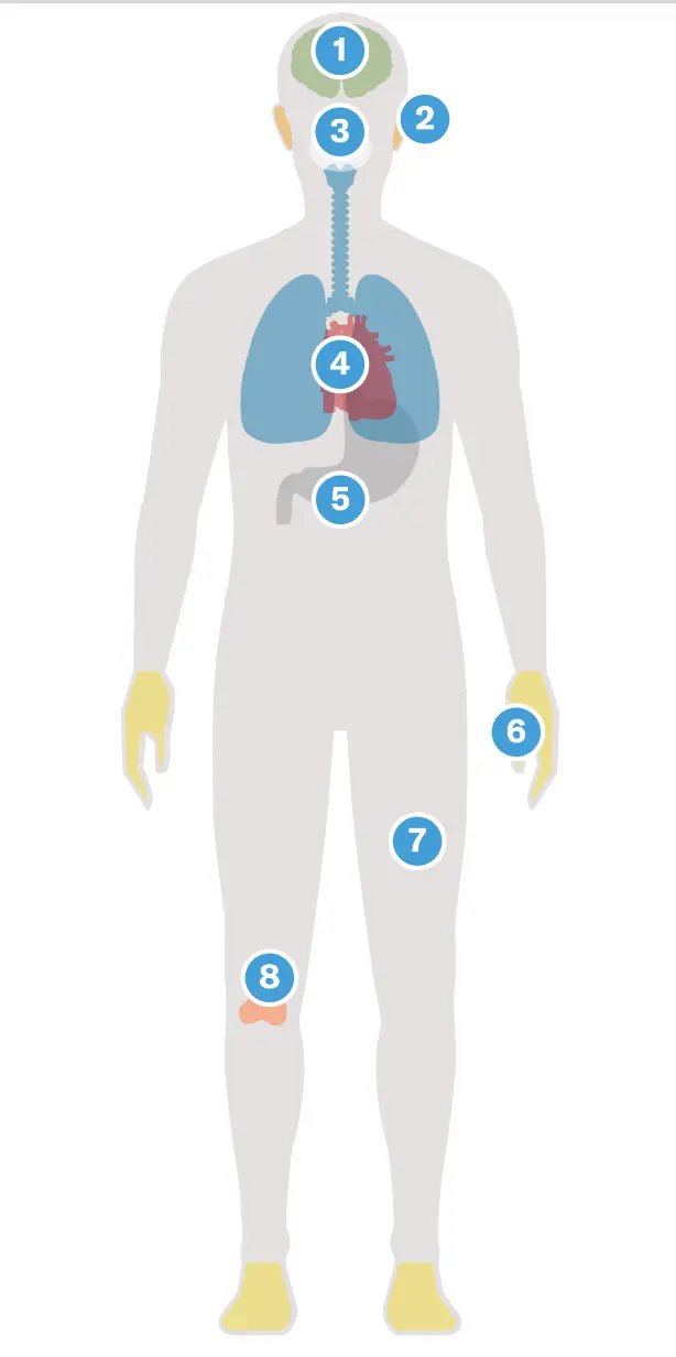 Infographic of the human body with numbered pins