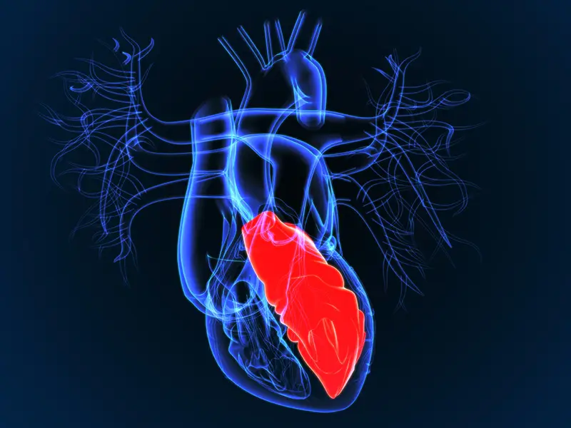 LVAD Therapy Offers Survival Outcomes Similar To Heart Transplant In Younger HF Patients