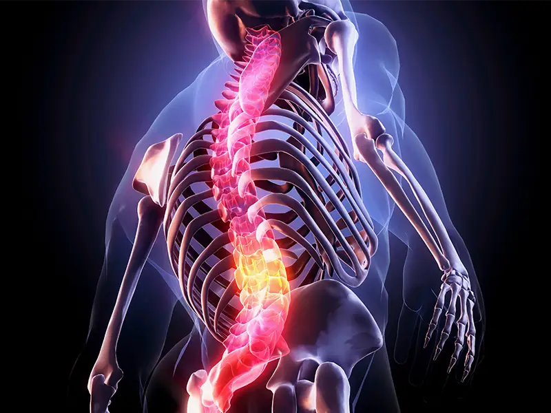 Awake Spine Surgery Designed For Anesthesia-Intolerant Patients 