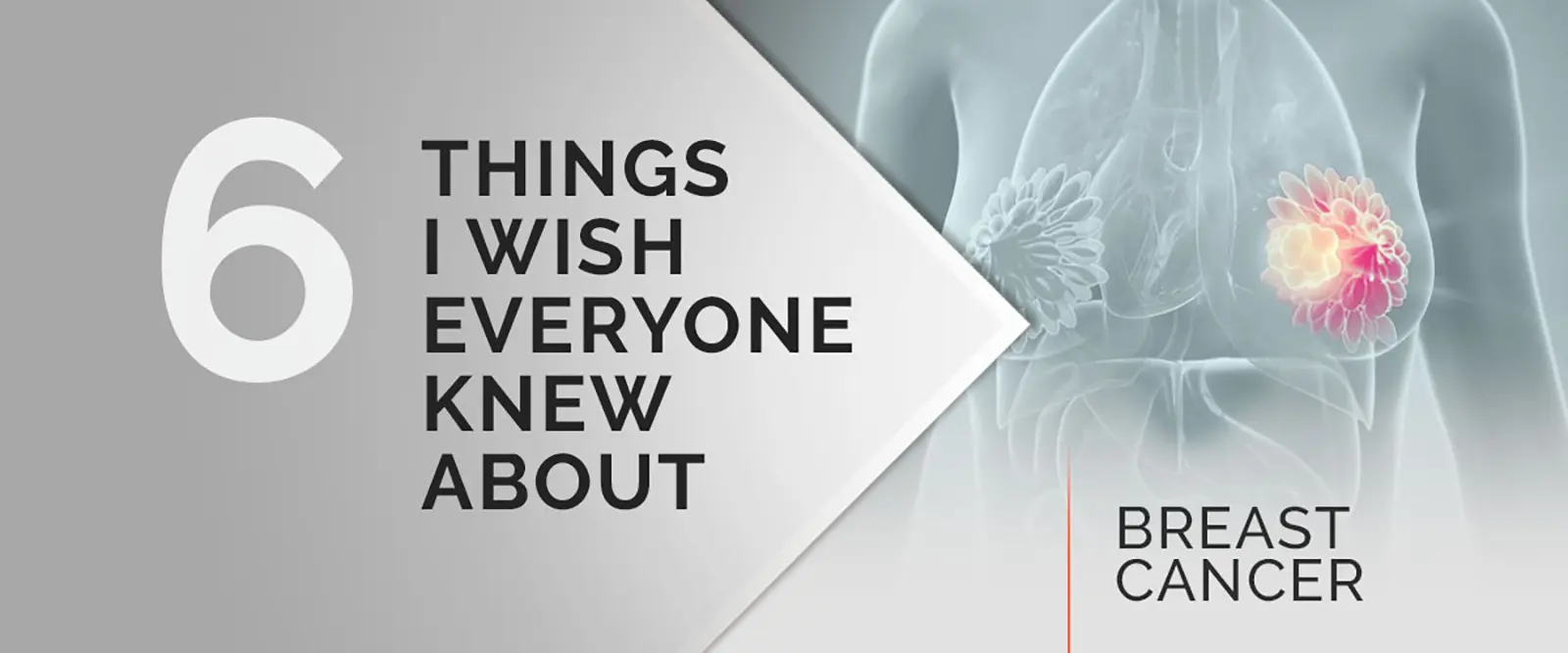 6 things I wish I knew about breast cancer