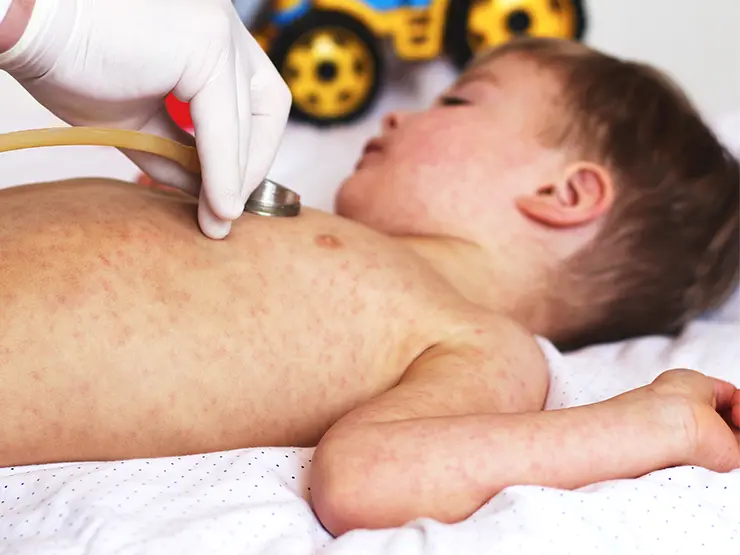 image of child getting checkup