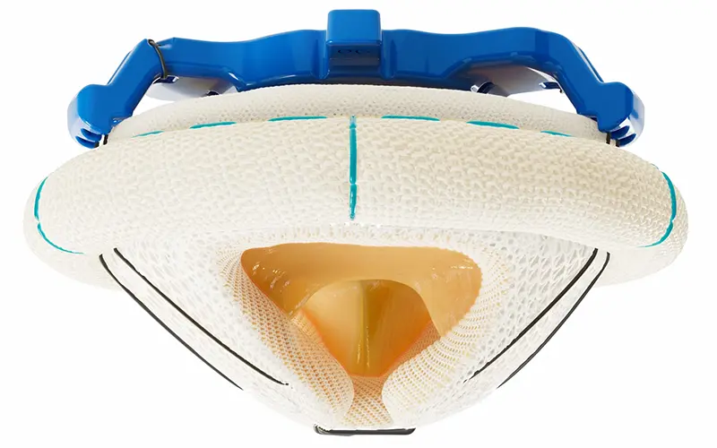 image of The Mosaic Neo valve