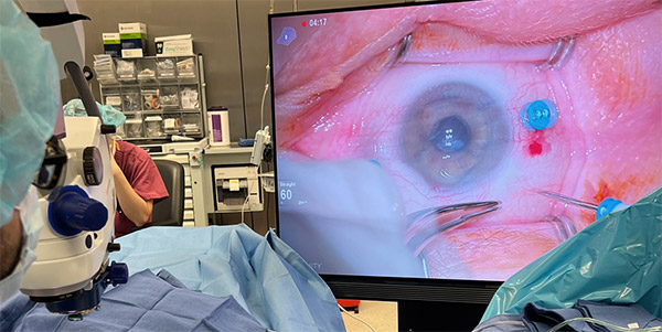 advances-ophthal-2023-01-3d-digital-visual-during-surgery