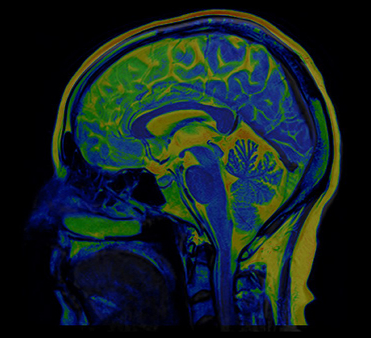 Medical Imaging Brain MRI Scan of Healthy Male ( Magnetic Resonance Imaging) High Resolution