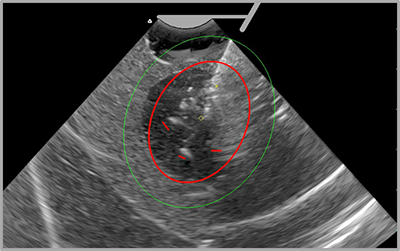 advances-gynecology-2021-smart-image
