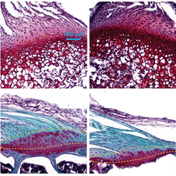 Where the Tendon Meets the Bone