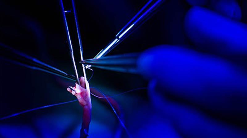 Vein graft preparation for CABG