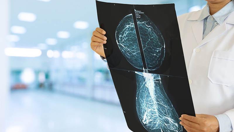 Reason for Optimism: Advancing Therapy for Triple-Negative Breast Cancer