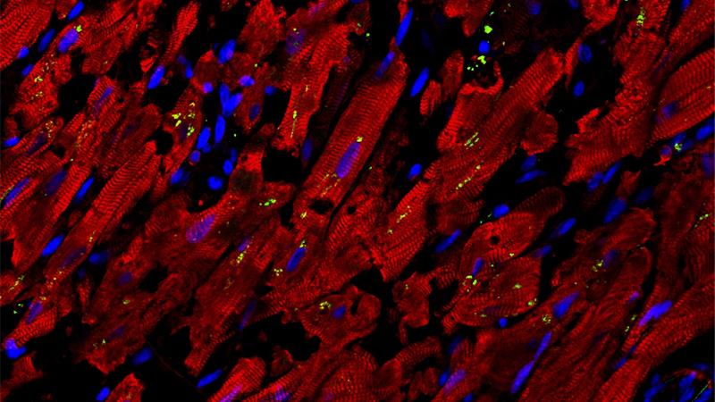 When COVID-19 Attacks the Heart
