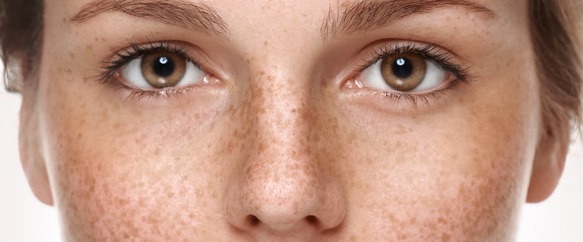 What’s Your Skin Cancer IQ?