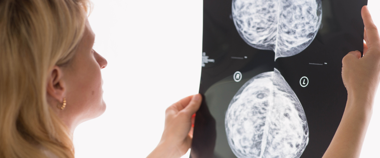 Swollen Lymph Nodes and the COVID-19 Vaccine: What to Know