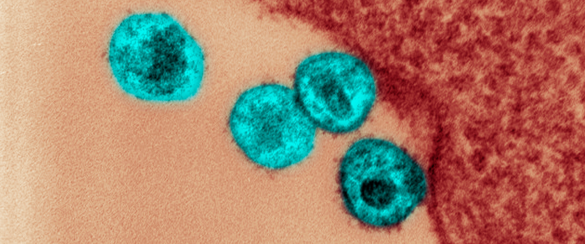 New Treatment Offers Hope for People Living With Drug-Resistant HIV