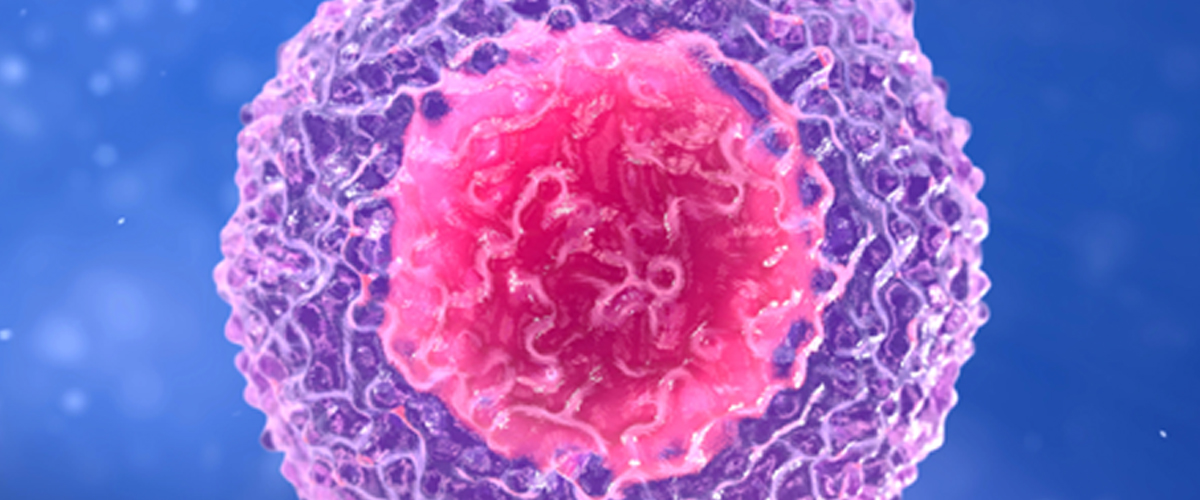 Small Study Finds Promising Treatment for Lupus