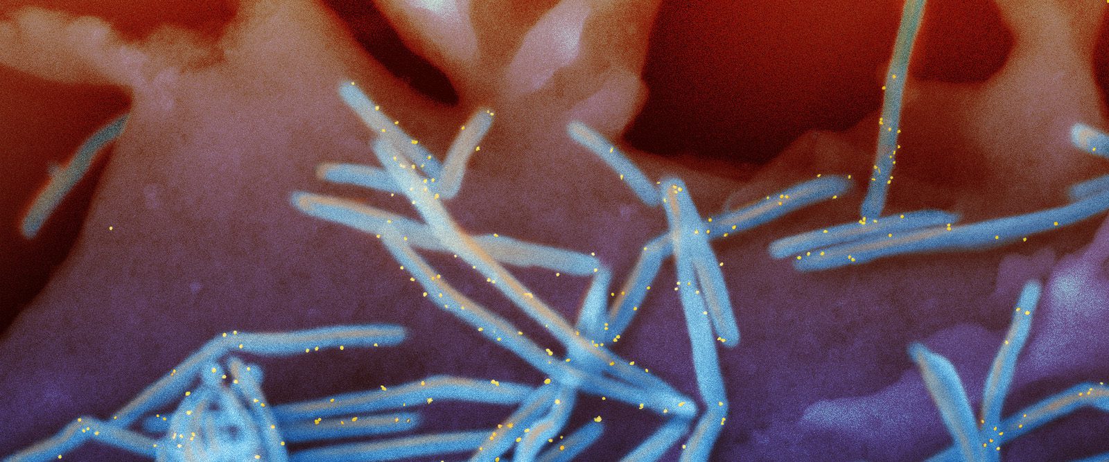 Protecting Children from RSV